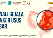 gejala kanker usus besar