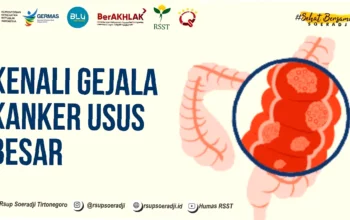 gejala kanker usus besar