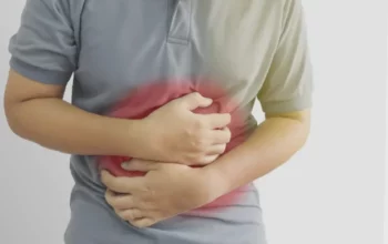 kanker usus besar