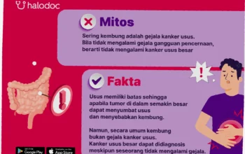 pengobatan kanker usus besar
