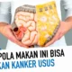 Rahasia Kanker Usus Besar Terungkap!  Mengenal Penyebab & Pencegahan