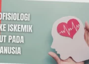 Rahasia Stroke Iskemik Terungkap!  Mengenal Penyebab & Cara Cegah