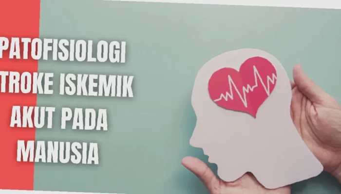 Rahasia Stroke Iskemik Terungkap!  Mengenal Penyebab & Cara Cegah