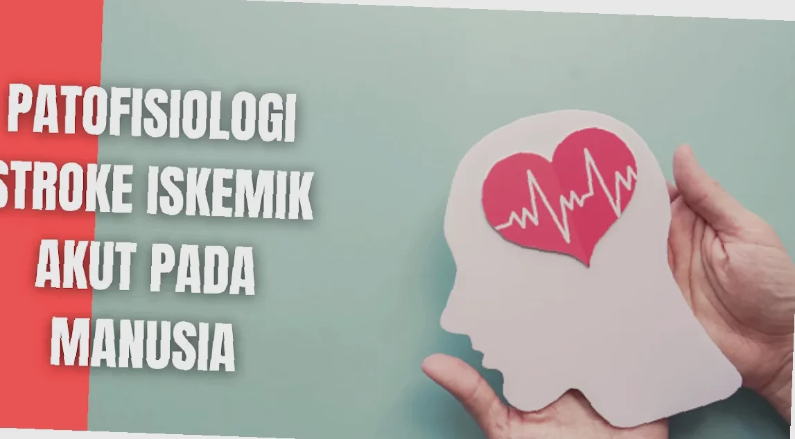 penyebab stroke iskemik