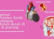 Penyumbatan Pembuluh Darah Otak Cepat Atasi Gejalanya Sekarang Juga