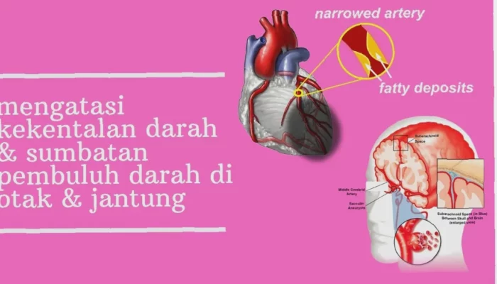 Penyumbatan Pembuluh Darah Otak Cepat Atasi Gejalanya Sekarang Juga