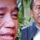 Mantan Presiden Jokowi Dikabarkan Mengalami Reaksi Kulit Parah, Terkait Sindrom Stevens-Johnson (SJS)