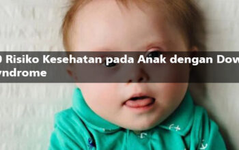 Down Syndrome