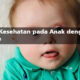Down Syndrome