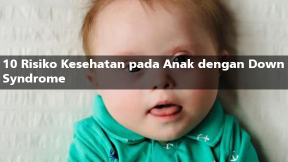Down Syndrome