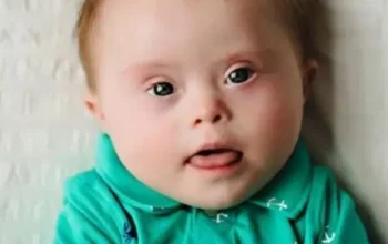 Terobosan Besar! Ilmuwan Berhasil Hapus Kromosom Ekstra dengan CRISPR, Buka Harapan Baru Pengobatan Down Syndrome