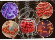 peran diet mikrobiota & prebiotik di kanker usus