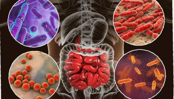 Siapa Sangka? Peran Diet, Mikrobiota & Prebiotik di Kanker Usus Ternyata Kunci Utama Perlawanan, Ubah Gaya Hidup, Selamatkan Usus Anda!