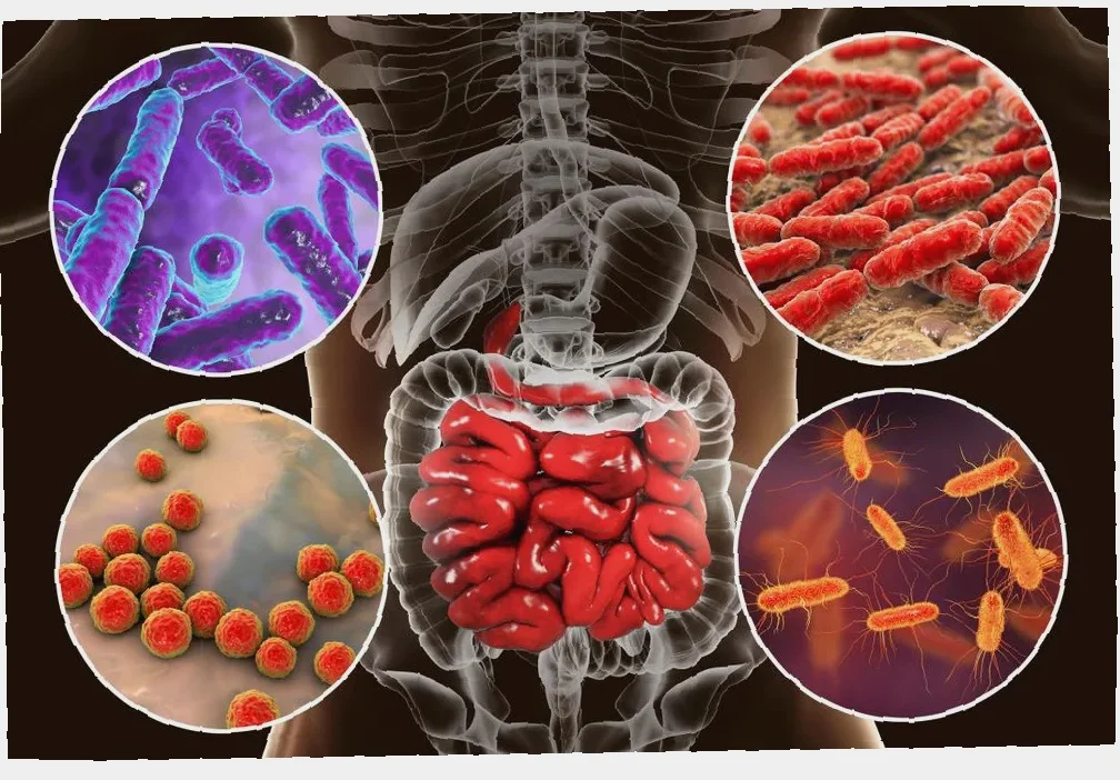 peran diet mikrobiota & prebiotik di kanker usus
